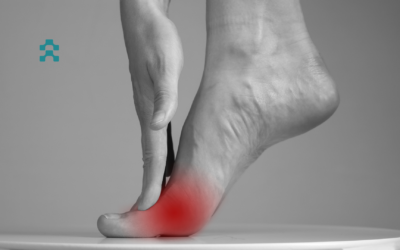 Φυσικοθεραπεία και Νεύρωμα Μόρτον (Morton neuroma)