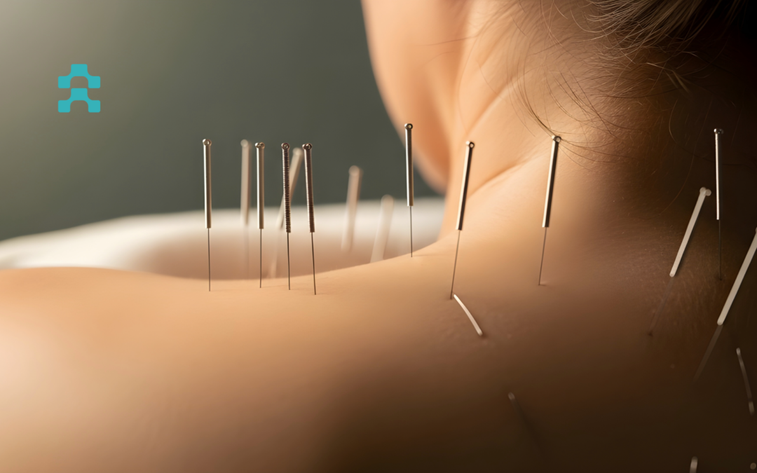 Βελονισμός – Πόνος στον Αυχένα: Μια Επιστημονική Προσέγγιση στην Ανακούφιση και τη Λειτουργικότητα