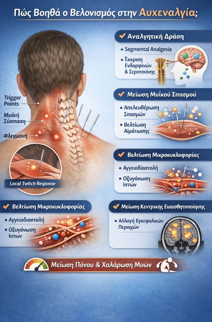 Βελονισμός - Πόνος στον Αυχένα